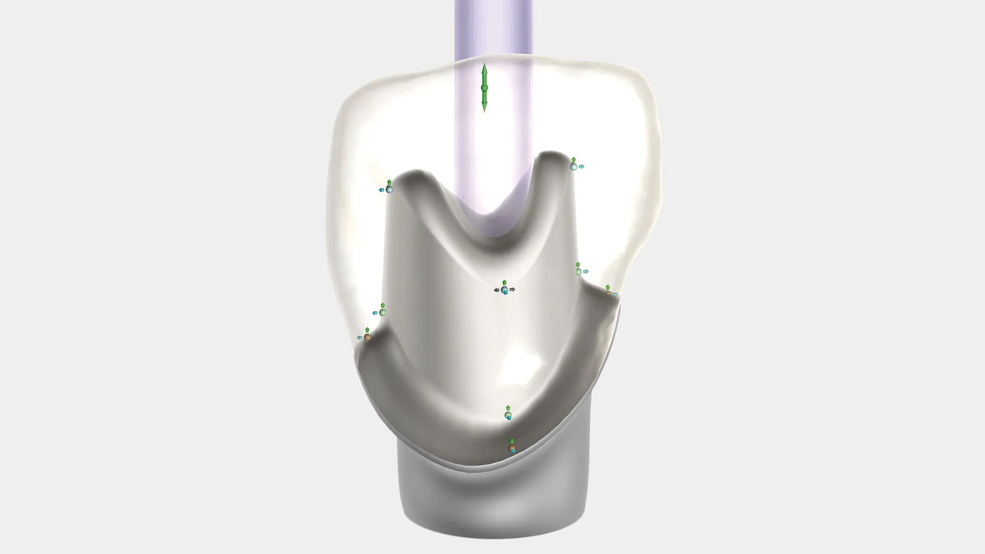 exocad - Implant Add On Module
